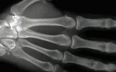 If You Were Told Not To Crack Your Knuckles Get Prepared For Some Satisfying News