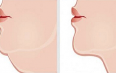 The Most Effective Exercises To Get Rid Of That Double Chin Quickly.