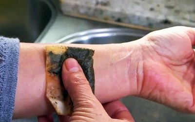 This Lady Puts A Used Tea Bag On Her Wrist. It Seemed Weird But The Reason Is Brilliant!