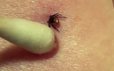 You Must Learn This Simple Tick Removal Trick Before You Go Outside This Spring