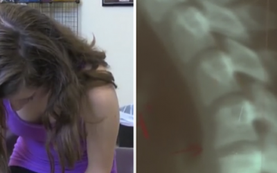 Teen Girl Was Feeling Intense Neck Pain. Her Parents Were Horrified After The Doctors Diagnosed Her.