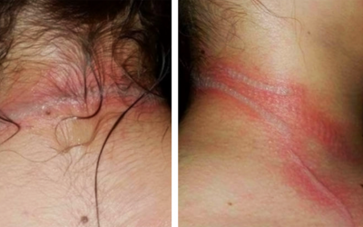 Teen Runs Downstairs To Her Mom In Excruciating Pain. The Reason Is Scary