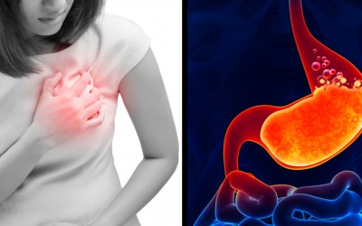 If You Always Get Heart Burn and Acid Reflux. THIS Is The Reason Why and How To Treat It Naturally.