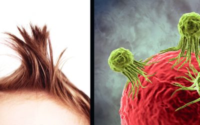 If You Have An Annoying Cowlick In Your Hair It Could Actually Save Your Life