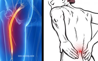 Simple Life Hacks To Relieve Sciatica and Lower Back Pain Quickly