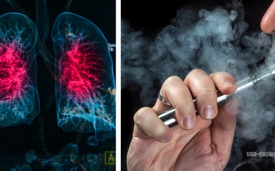 Doctors Warn People To Stop Using E-Cigs Because They Are Linked To a New Disease Popcorn Lung