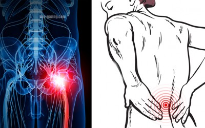3 Simple Ways To Get Rid Of Your Lower Back Pain and Sciatica Without Pills or Surgery