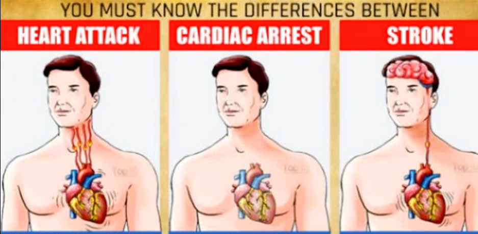 How to tell if having heart attack