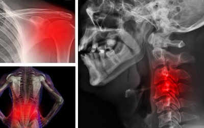 7 Kinds Of Chronic Body Pains Which Could Be Caused By Your Psychological/Emotional States