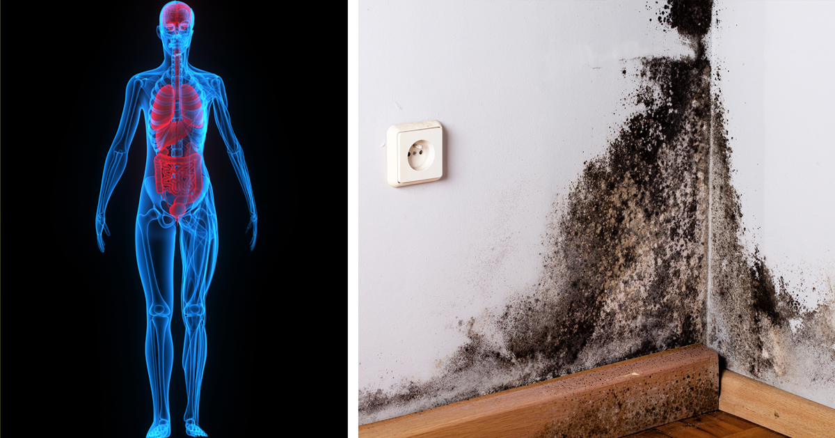 6 Signs You Have Mold Illnesay Not Even Know It 3gg33gg33gg3g3g3g3g33g3g3gg3g33g
