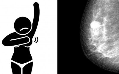 Signs and Symptoms You Have Breast Cancer and May Not Even Know It.