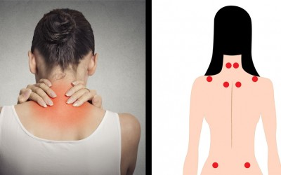 5 Signs and Symptoms You Have Fibromyalgia and May Not Even Know It.