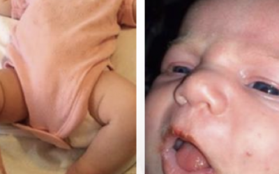 This Baby Almost Died Because She Was Kissed. The Reason Is So Scary!