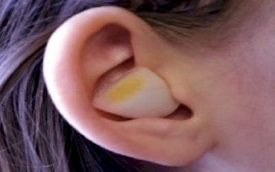 Apparently If You Put An Onion In Your Ear Overnight THIS Happens To Your Body.
