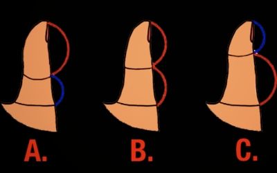 What Does The Length Of Your Thumb Reveal About Your Love Relationships? Find Out.