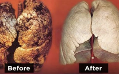 Apparently This Is How You Can Cleanse Your Lungs In Only a Few Days!