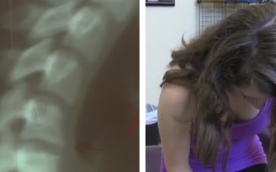This Teen Was Feeling Extreme Neck Pain. When The Doctors Diagnosed Her, Her Parents Were Horrified!