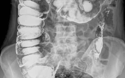 Apparently This Is What Happens When You Eat Garlic On An Empty Stomach In The Morning!