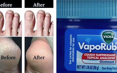 Apparently I’ve Been Using Vicks VapoRub Wrong This Whole Time. Here Are 7 Surprising Uses!