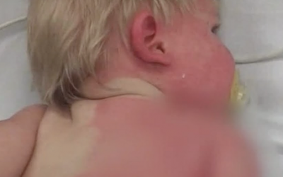 Mom Was Filling Up The Pool When Her Baby Got Splashed and Started Crying. The Reason Is Scary!