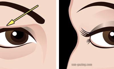 If Your Eyelids Tend To Droop and Sag THIS Life Hack Is The Best Natural Way To Fix It.