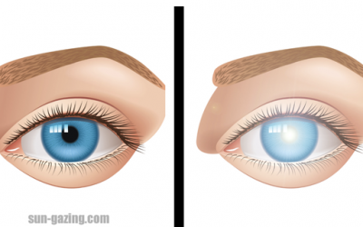 Two Women Have Gone Blind Because of Something We All Do Everyday. I Had No Idea.