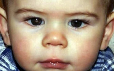 His Aunt Noticed A Deadly Disease In Her Nephew’s Picture. This Is How She Realized It..