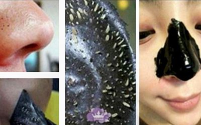 The Easiest Way To Remove Those Gross Blackheads For Good Overnight!