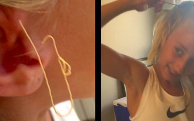 She Got Her Mother To Help Her Pop THIS Giant 6 Year Old Pimple. The Results Are Oddly Satisfying!