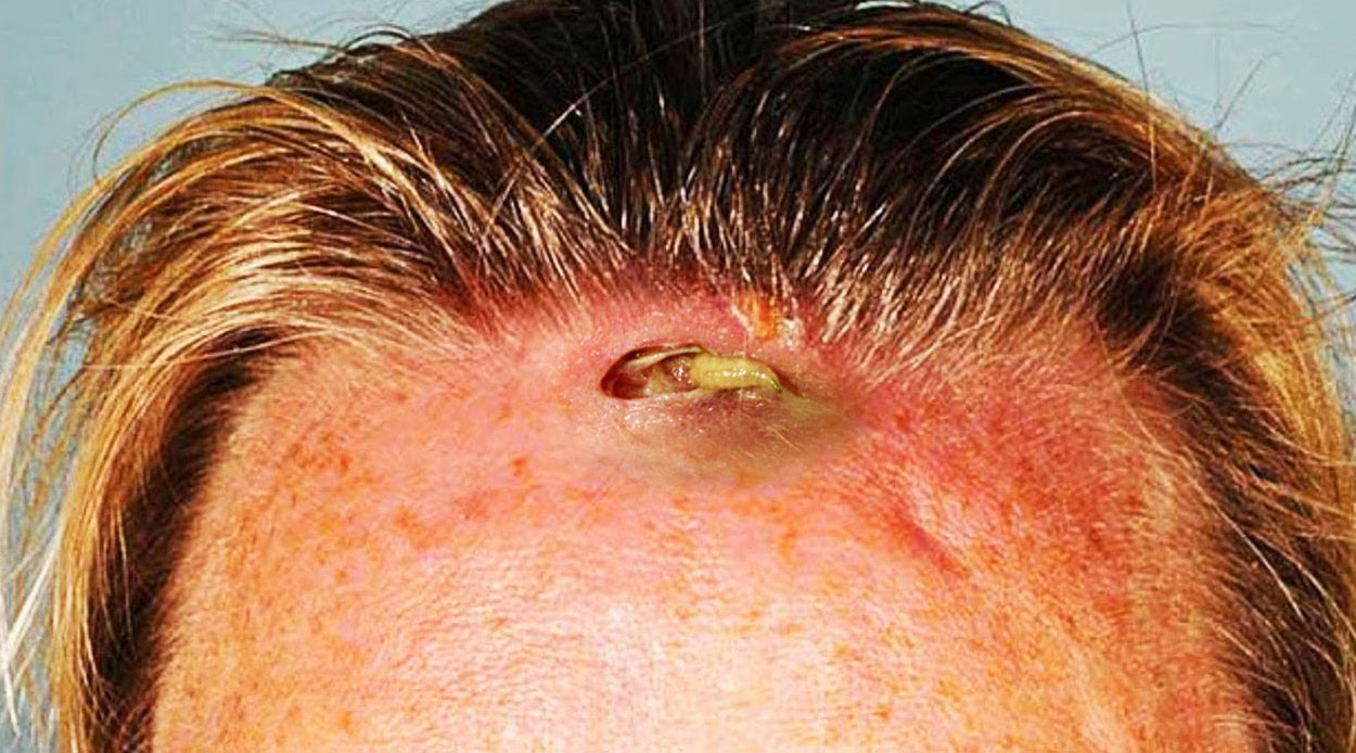 She Goes To Her Doc With Pain and Swelling On Her Forehead. He Looks At