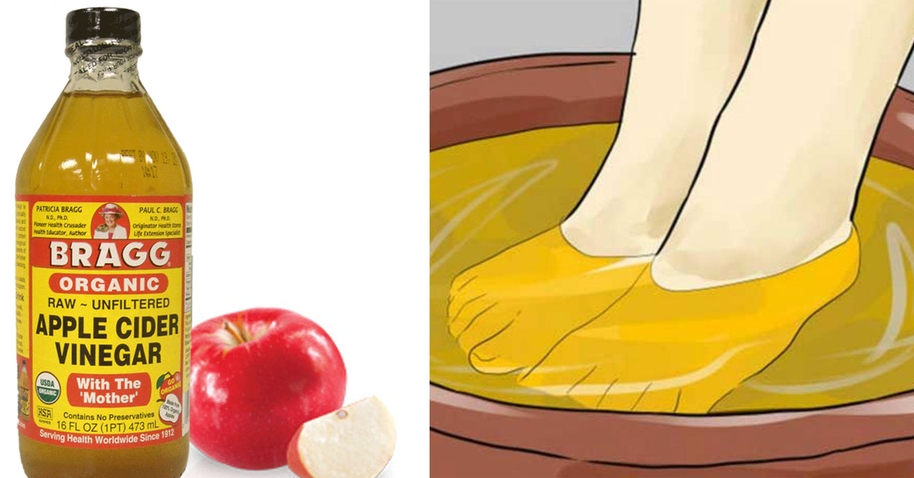 She Puts Her Feet In Apple Cider Vinegar For 30 Minutes a Day For a