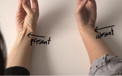 This Is The Strange Reason Your Tendon Protrudes Out Of Your Wrist Like That.