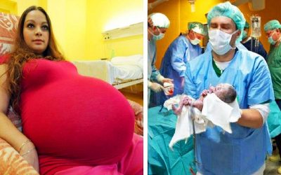 Mother Believes She Was Giving Birth To Twins.