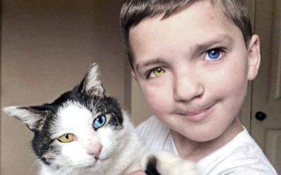 This Little Boy With an Eye Defect and Disorder Found a Cat Who Has His Same Condition.