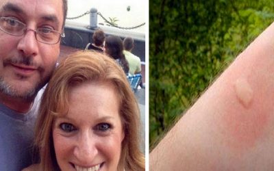 THIS Woman’s Husband For Over 26 Years Died From THIS Common Bug Bite!